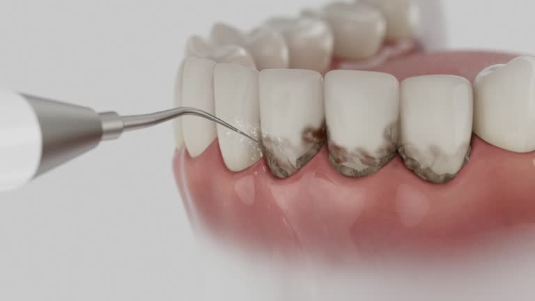 Reliable Teeth Whitening contractor in Edgewater, FL by Smile Center Dentistry